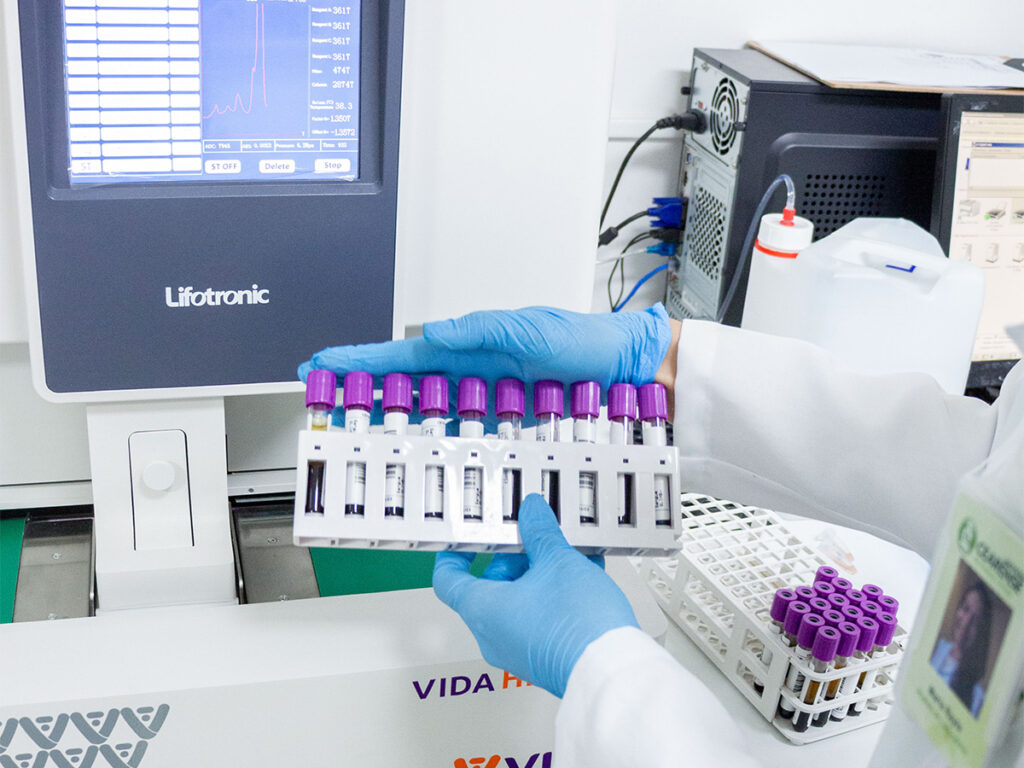 check-up-laboratorial